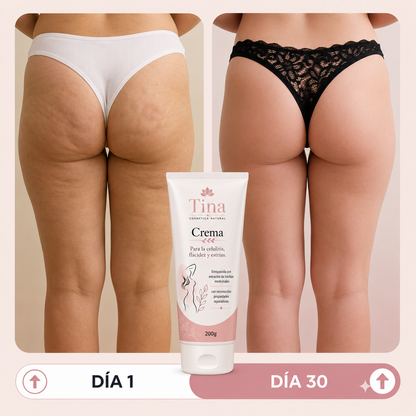 Tina™ | Crema Anticelulitis Reafirmante – Reduce la Piel de Naranja