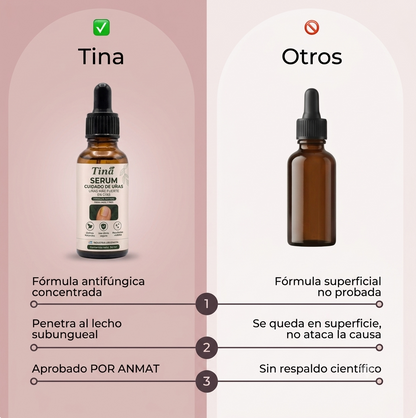 TINA: El Serum que elimina el 99.9% de los hongos en tus uñas.